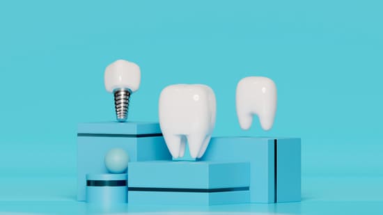 Жизнь с зубными имплантами